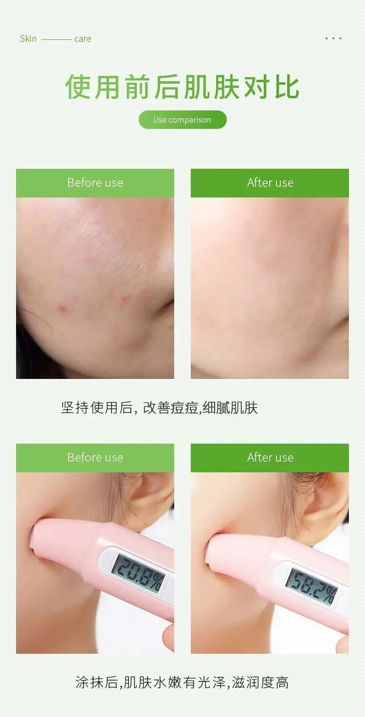 260ml aloe vera gel moisturizing and brightening skin tone acne-removing aloe vera gel after-sun gel moisturizing cream luvshop24