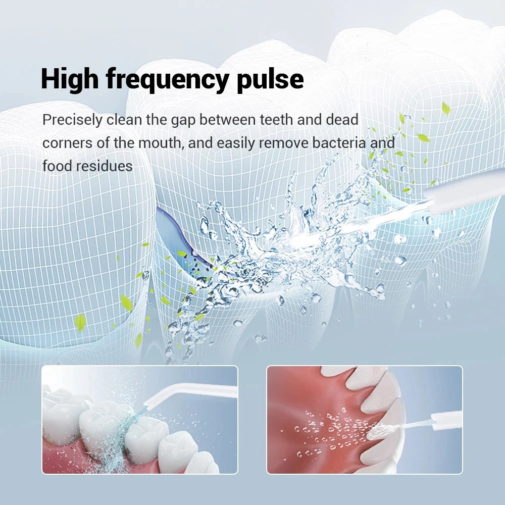 YOUPIN Xiaomi Oral Irrigator Water Flosser Electric Dental Whitening USB Rechargeable Gums Care Portable Jet Tooth Scaler MI NEW luvshop24