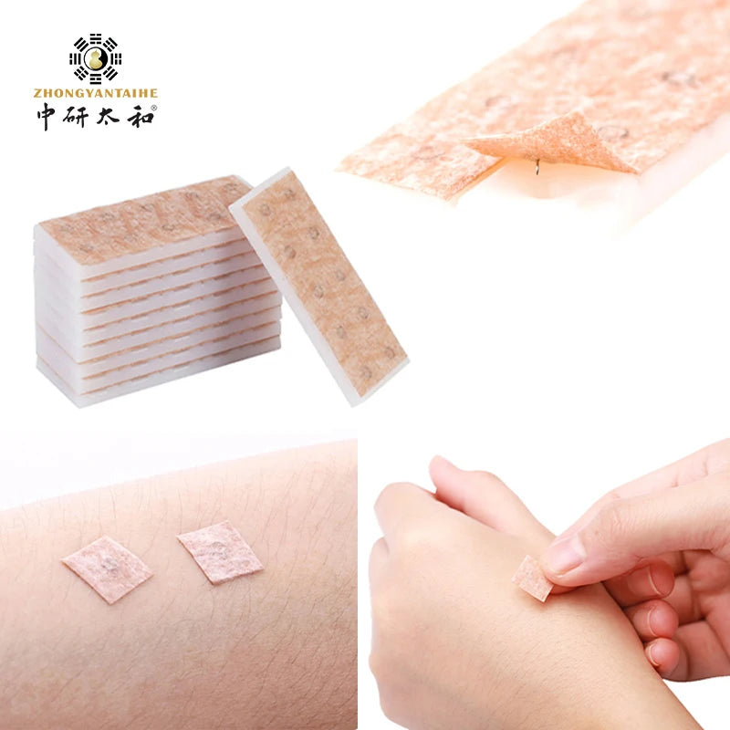ZHONGYAN 100Pcs Ear Acupuncture Needle Disposable Press Needle for Ear Sticker Acupuncture Patches Skin Needl Massage Relaxation luvshop24