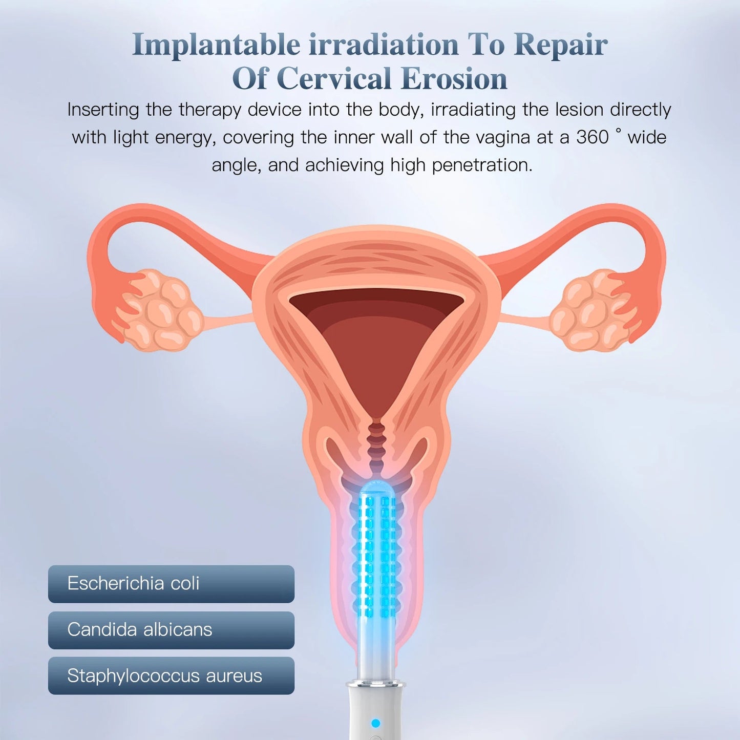 KTS Vaginal Vibrator Wireless Vaginal Massager Red Light Therapy Device for Vaginitis Female Sex Wand Vaginal Tightening Device luvshop24