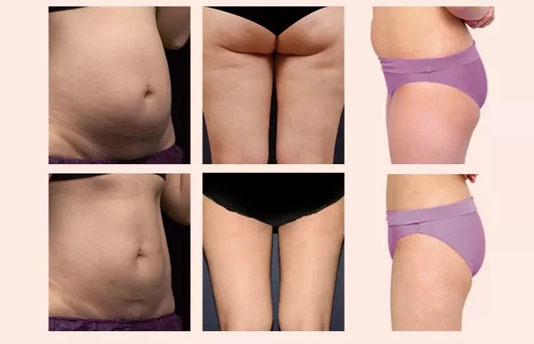 4 in 1 Vacuum Ultrasonic Cavitation 40HKZ Vela Body SHAPE Cellulite Reduction Infrared Light 940NM Face Body Slimming Machine luvshop24