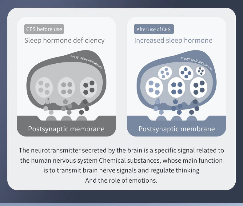 Insomnia Anxiety Depression Ces Therapy Device Anxiety Electronic Acupuncture Apparatus Sleeping Aid Device luvshop24