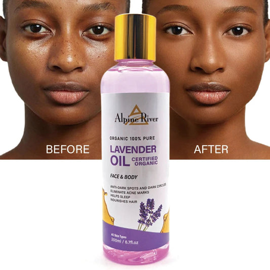 100% Natural Organic Vitamin E Body Oil Remove Dark Spots Eliminate Dark Circles Help Sleep Lavender Massage Oil luvshop24