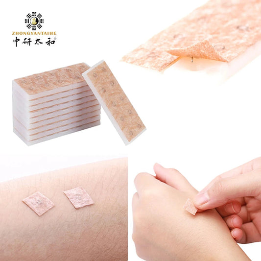 ZHONGYAN 100Pcs Ear Acupuncture Needle Disposable Press Needle for Ear Sticker Acupuncture Patches Skin Needl Massage Relaxation luvshop24