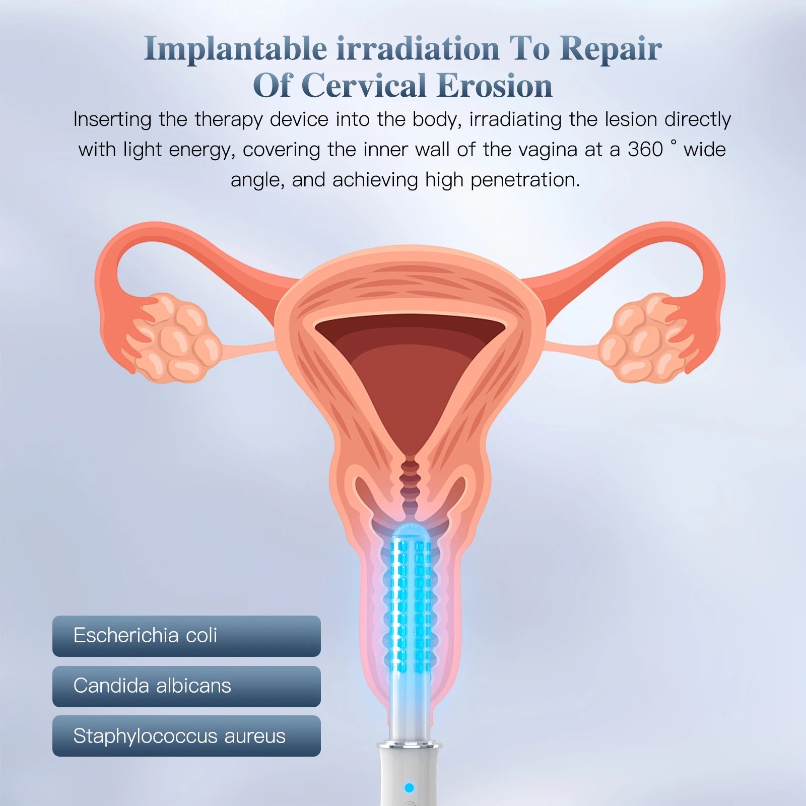 KTS Vaginal Vibrator Wireless Vaginal Massager Red Light Therapy Device for Vaginitis Female Sex Wand Vaginal Tightening Device luvshop24