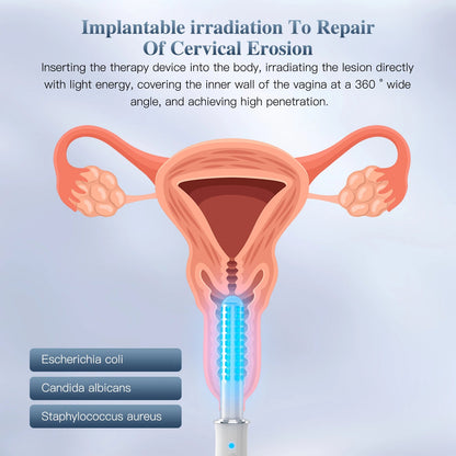 KTS Vaginal Vibrator Wireless Vaginal Massager Red Light Therapy Device for Vaginitis Female Sex Wand Vaginal Tightening Device luvshop24
