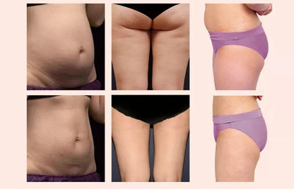 4 in 1 Vacuum Ultrasonic Cavitation 40HKZ Vela Body SHAPE Cellulite Reduction Infrared Light 940NM Face Body Slimming Machine luvshop24